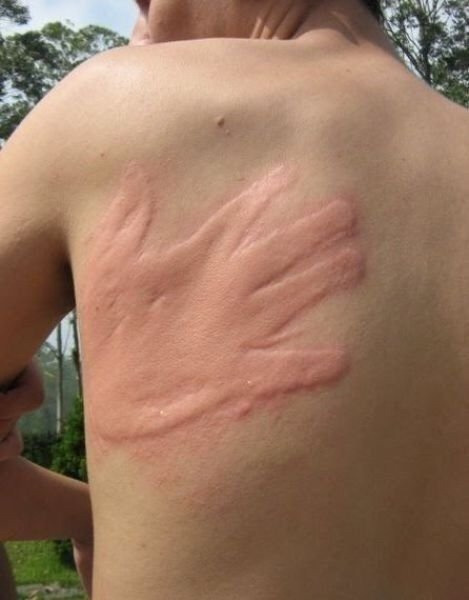 등짝 스매싱 아내 와이프 남편 등 손자국