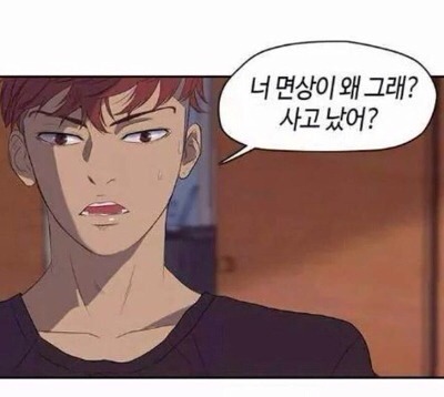 면상 못생김 사고 났어 왜그래 싫어