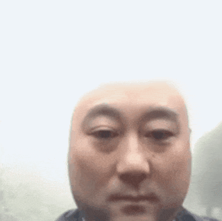 대머리 역광 마술 기술 머머리 빡빡이 탈모