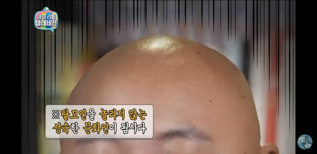 대머리 탈모 놀리지 않는 성숙한 문화인이 됩시다
