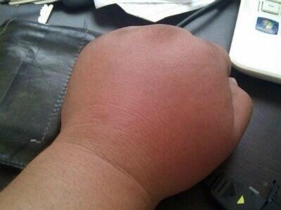 주먹 도라에몽 꿀주먹 레전드