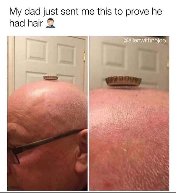 대머리 초전도체 병뚜껑 공중부양