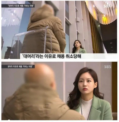 대머리 채용거부 대머리라는 이유로 채용 취소당해