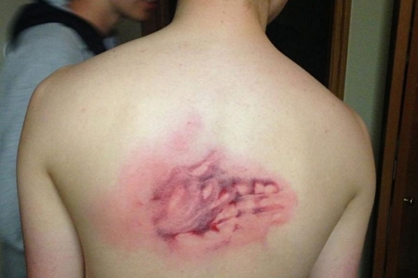 등짝 스매싱 잘못 손자국 스메싱 남편 등짝을 피멍 와이프 아내 혼남