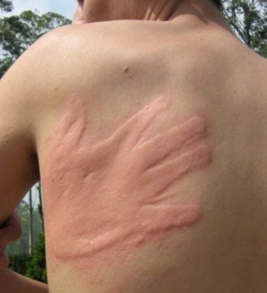 등짝 스매싱 레전드 역대급 손모양 손도장