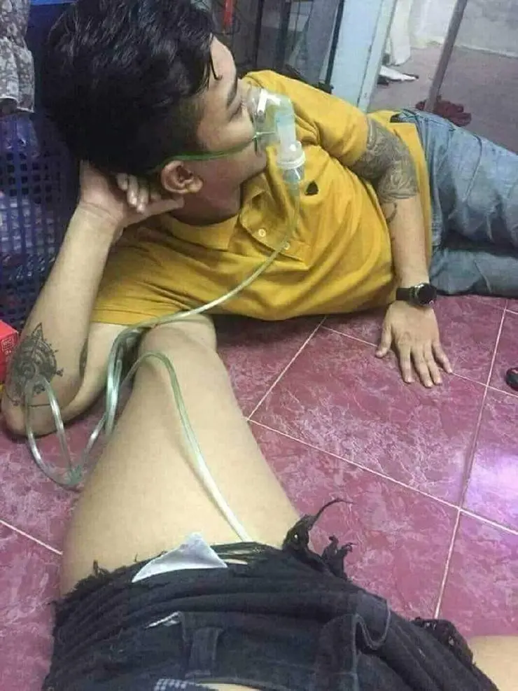 인공 호흡기