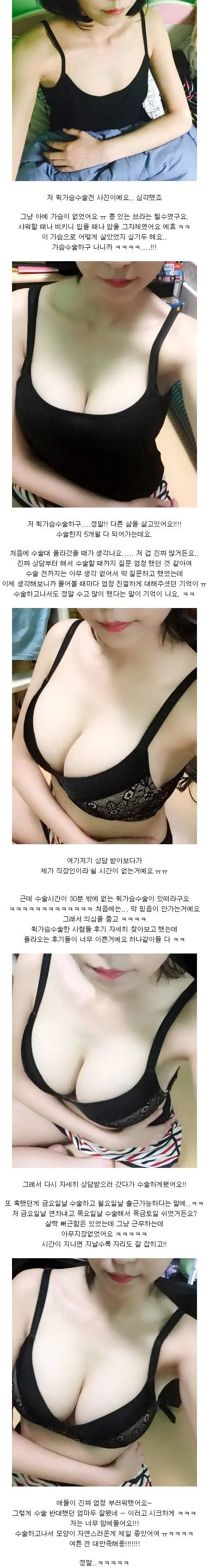 퀵 가슴 수술 후기