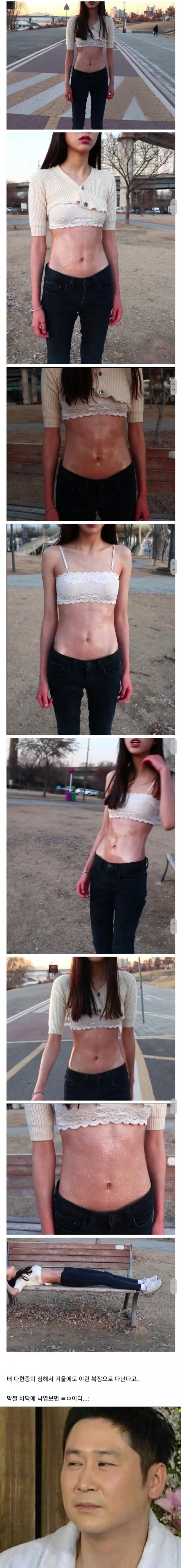복부에 다한증이 심한 여성.